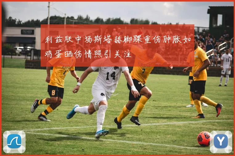 利兹联中场斯塔赫脚踝重伤肿胀如鸡蛋晒伤情照引关注
